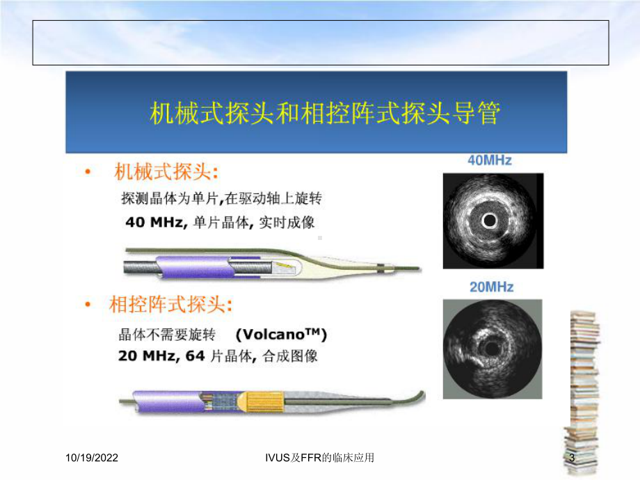 IVUS及FFR的临床应用课件.ppt_第3页