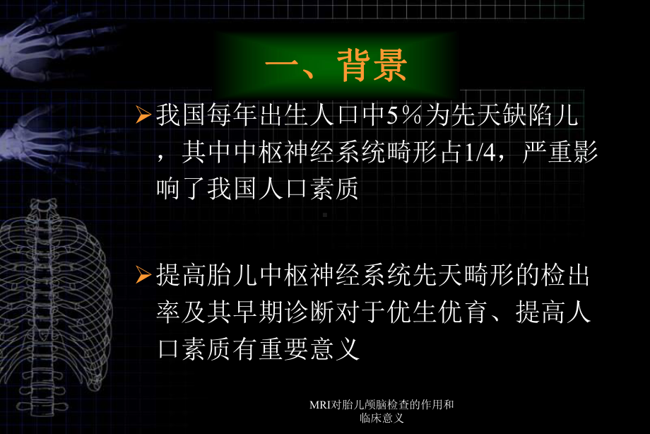 MRI对胎儿颅脑检查的作用和临床意义课件.ppt_第2页