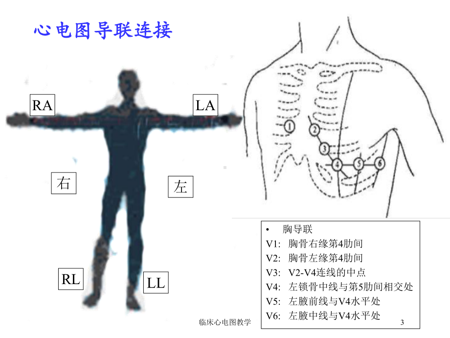 临床心电图教学培训课件.ppt_第3页