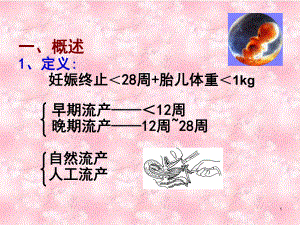 临床医学概论妊娠早期出血性疾病课件.ppt