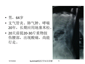 kummell病医学知识讲解课件.ppt