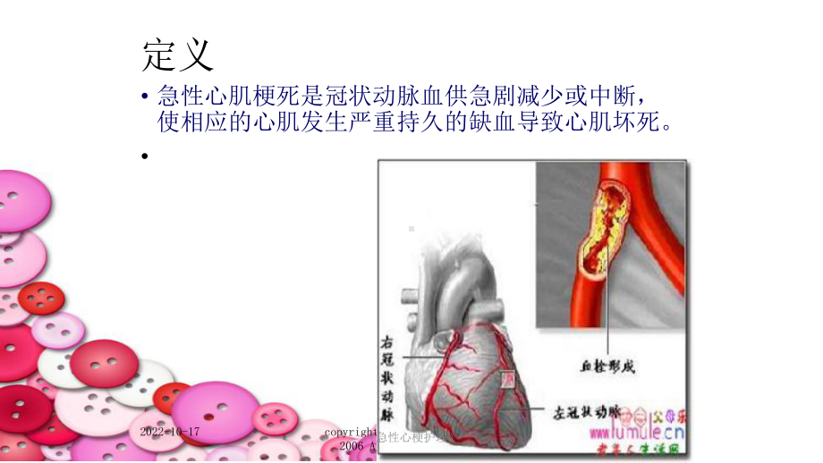 《急性心梗护理》课件.ppt_第3页