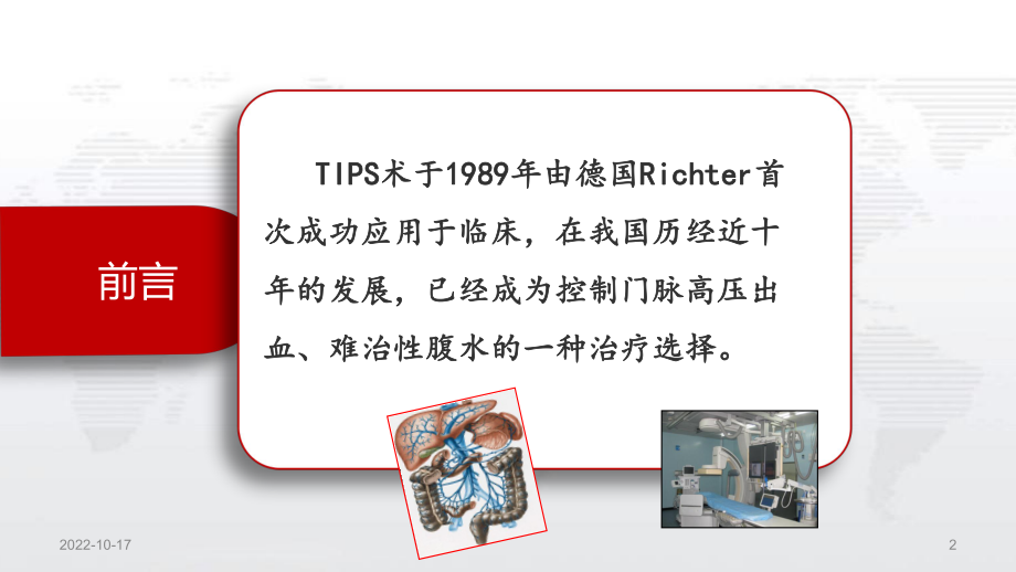 TIPS护理查房参考课件.ppt_第2页