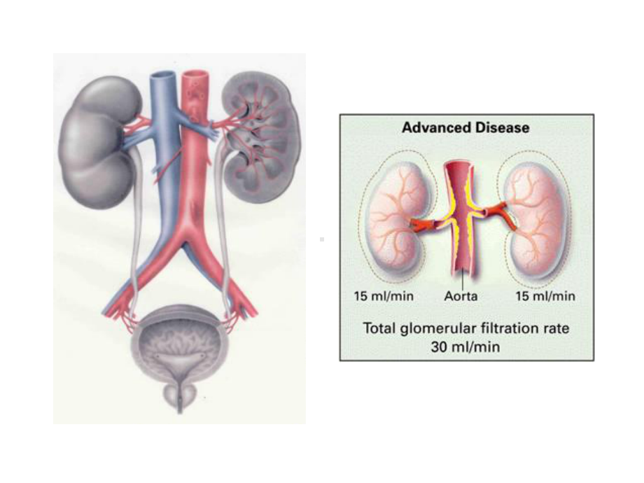 医学肾动脉狭窄影像学检查方法的优化选择课件.ppt_第2页
