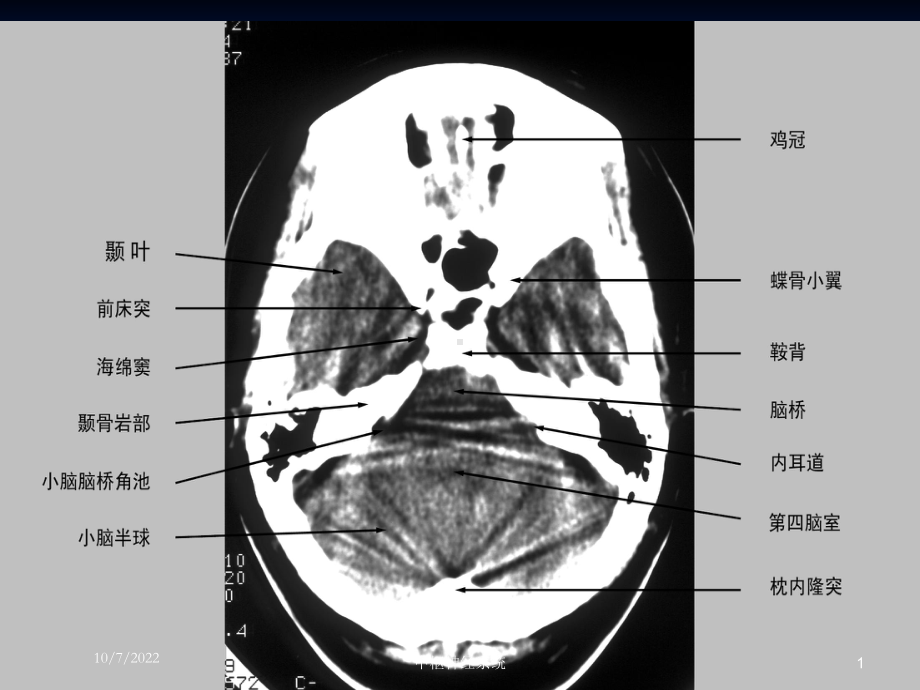 中枢神经系统培训课件.ppt_第1页