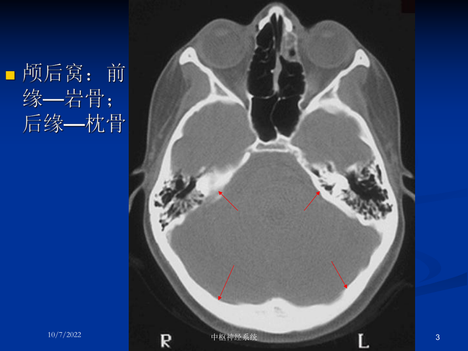 中枢神经系统培训课件.ppt_第3页