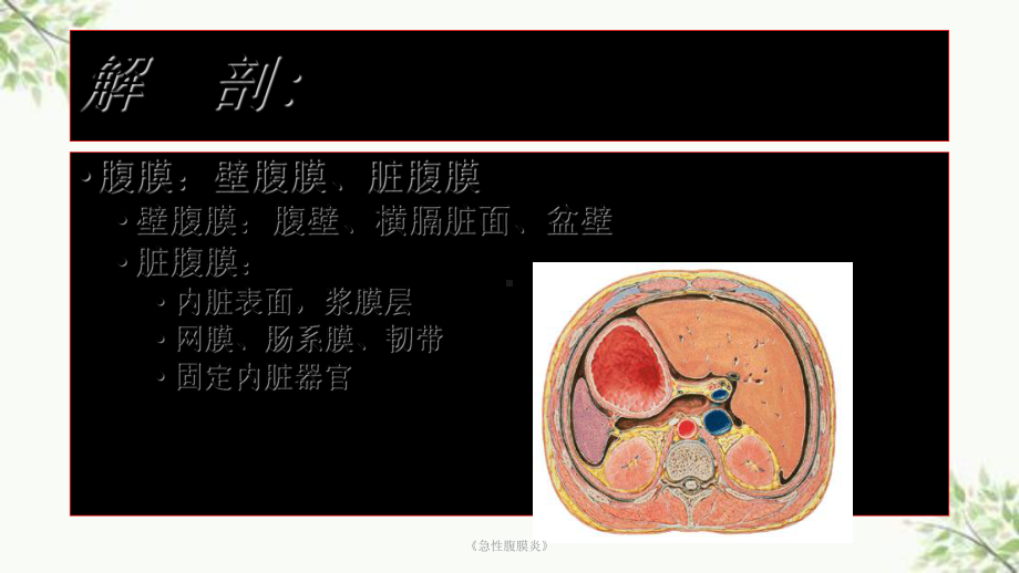 《急性腹膜炎》课件.ppt_第3页