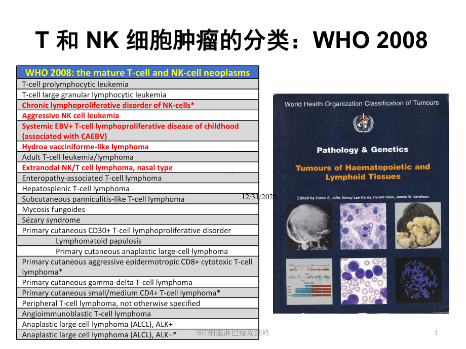 NKT细胞淋巴瘤课件.ppt_第1页