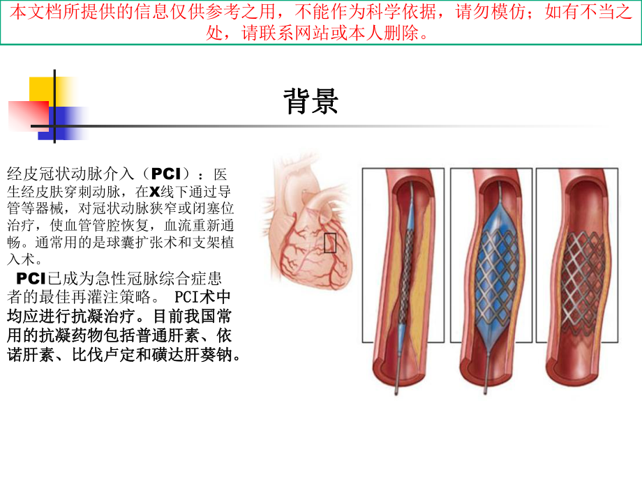 PCI围术期抗凝治疗中比伐卢定和肝素的比较培训课件.ppt_第2页