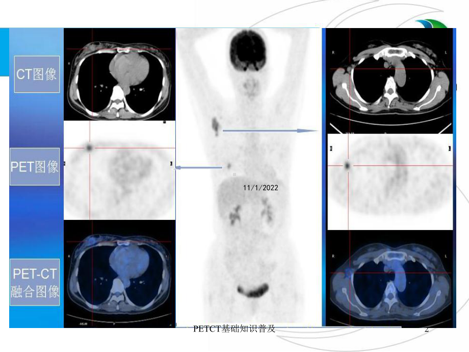 PETCT基础知识普及课件.ppt_第2页