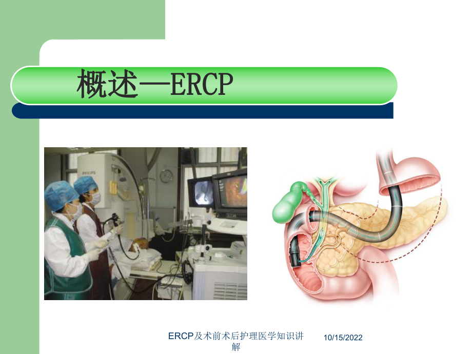 ERCP及术前术后护理医学知识讲解课件.ppt_第3页