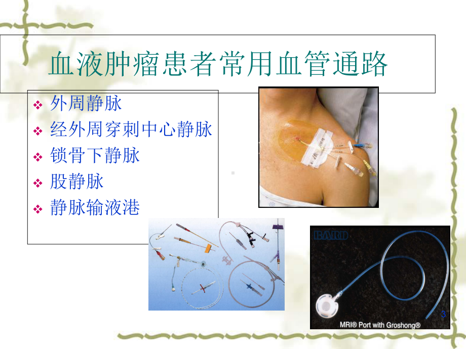 CT-PICC临床应用医学课件.ppt_第3页