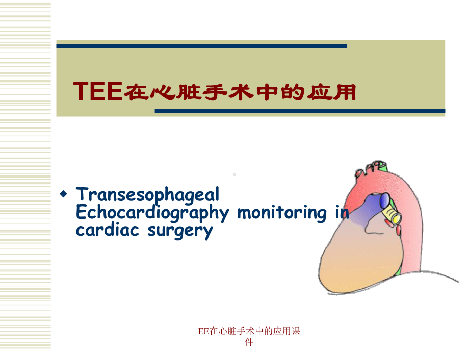 EE在心脏手术中的应用课件.ppt_第1页