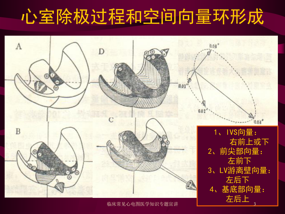 临床常见心电图医学知识专题宣讲培训课件.ppt_第3页