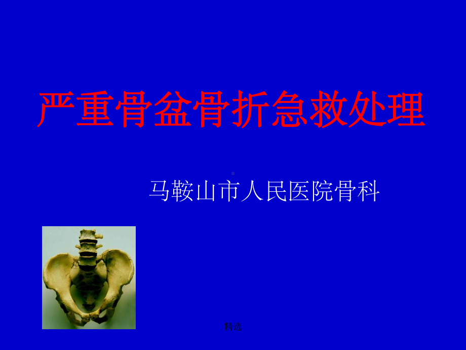 严重骨盆骨折的急救处理课件-2.ppt_第1页