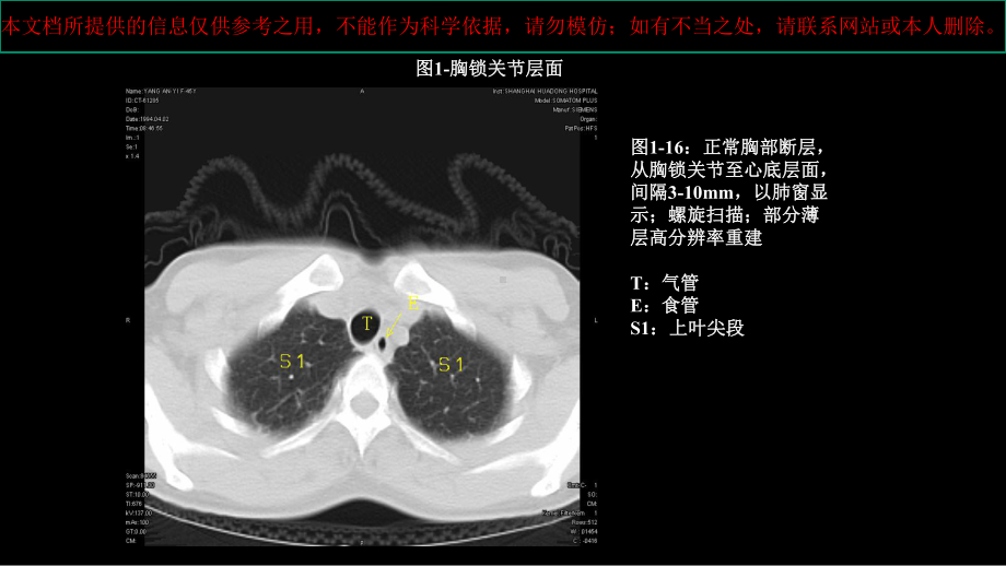 CT肺叶分段和纵膈淋巴结分组培训课件.ppt_第1页