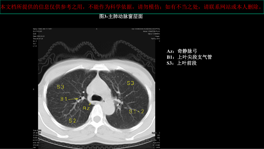 CT肺叶分段和纵膈淋巴结分组培训课件.ppt_第3页