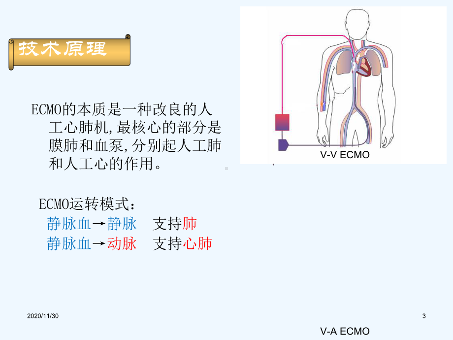 ECMO治疗危重患者进展课件.ppt_第3页