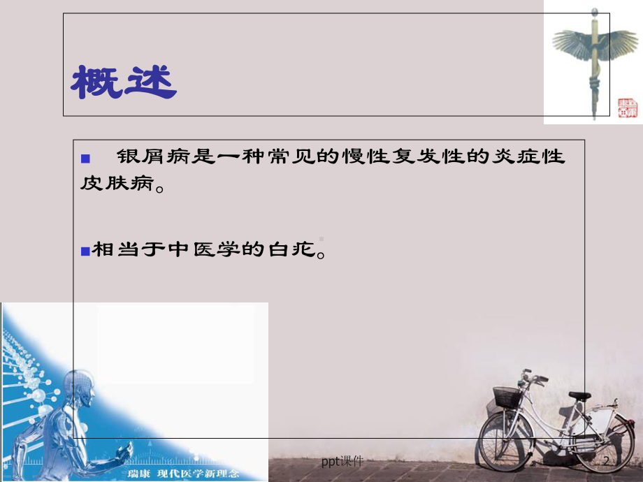 中西医结合外科银屑病-课件.ppt_第2页