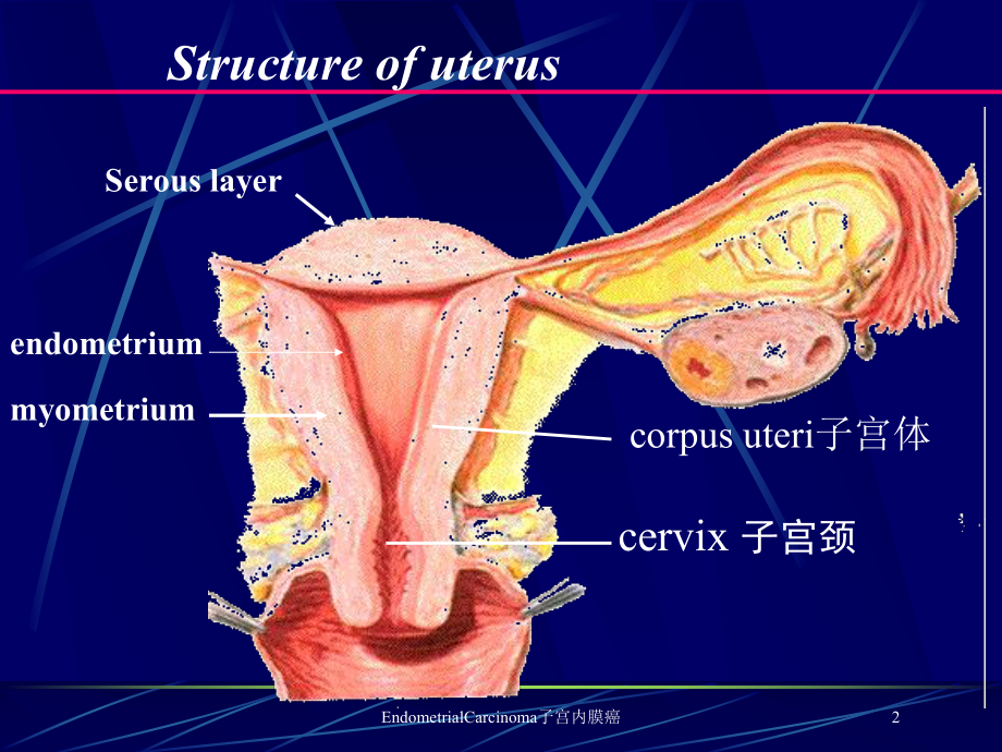 EndometrialCarcinoma子宫内膜癌培训课件.ppt_第2页