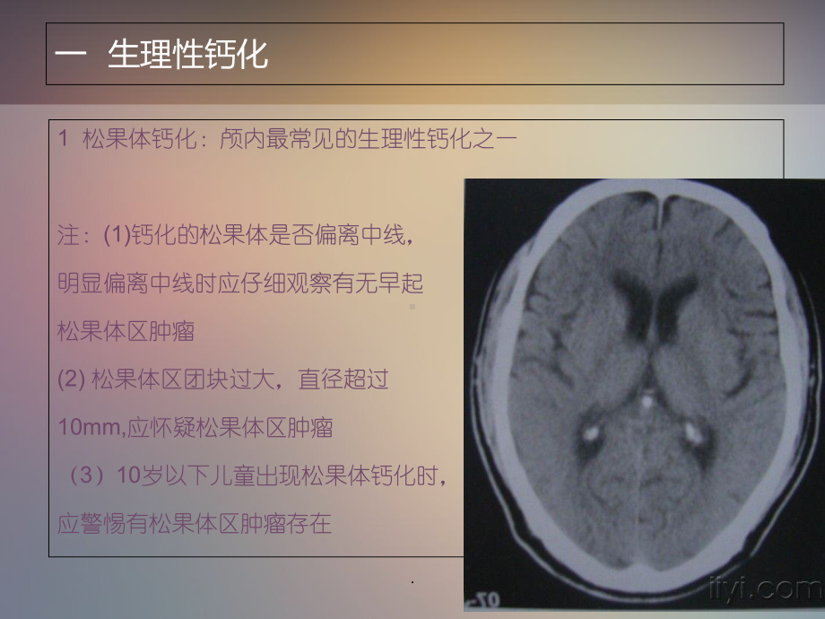 (优质医学)颅内钙化的CT表现教学课件.ppt_第3页