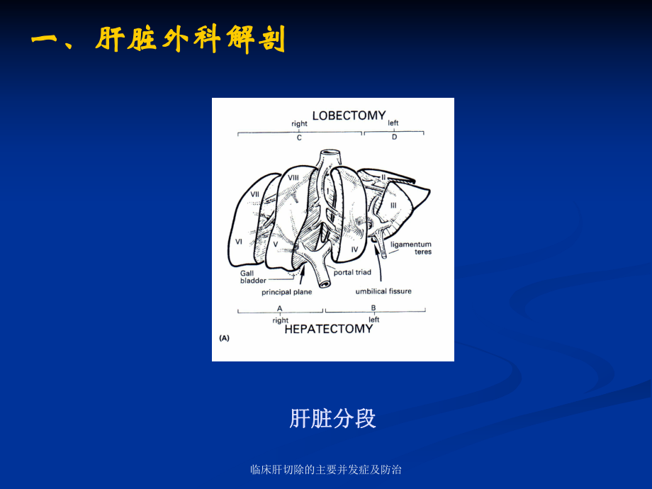 临床肝切除的主要并发症及防治课件.ppt_第2页