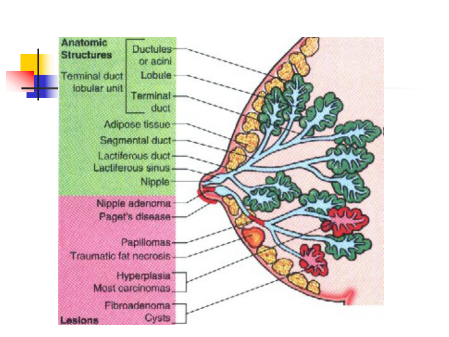 femalebreastdisease乳腺教学课件.ppt_第2页