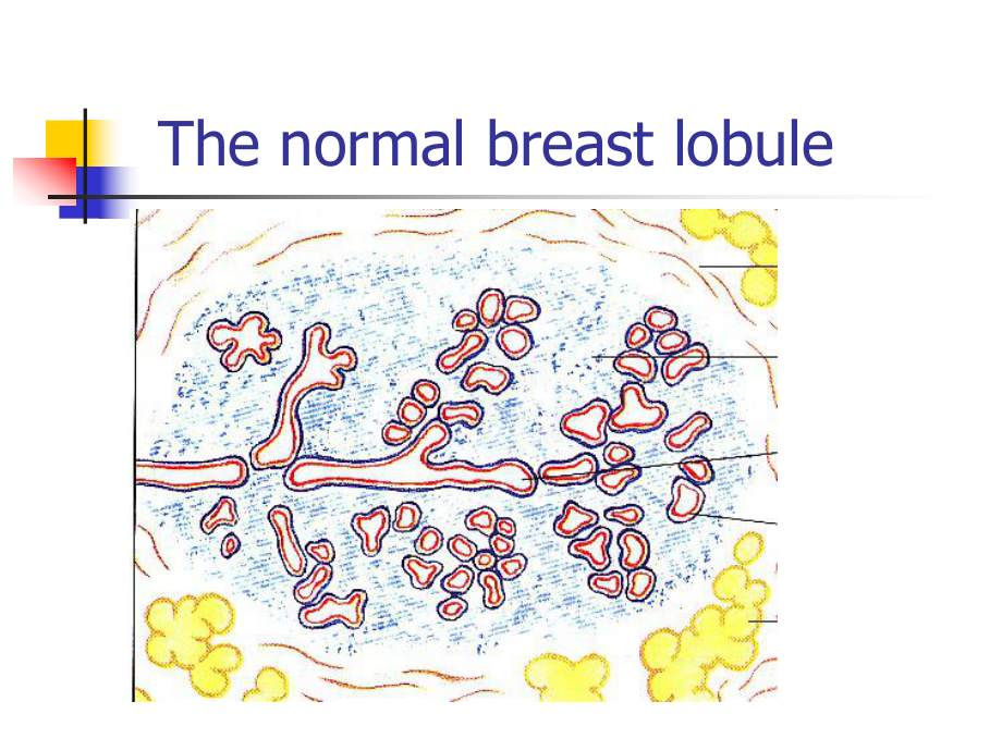 femalebreastdisease乳腺教学课件.ppt_第3页