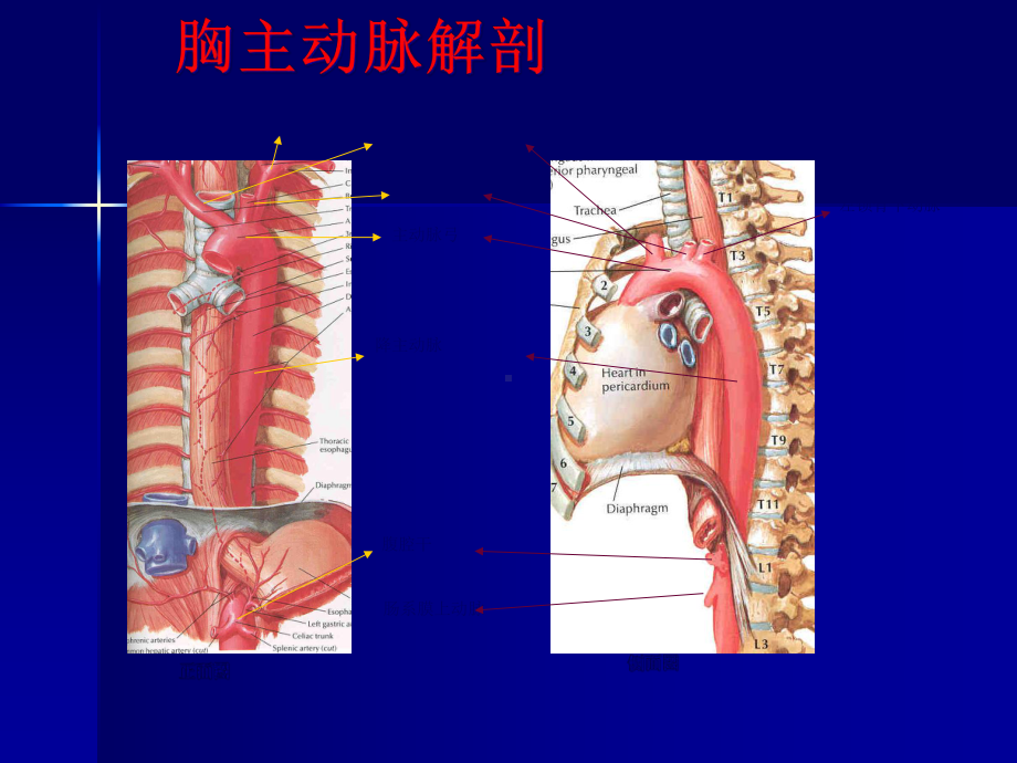 主动脉夹层及腹主动脉瘤CA影像课件.pptx_第2页