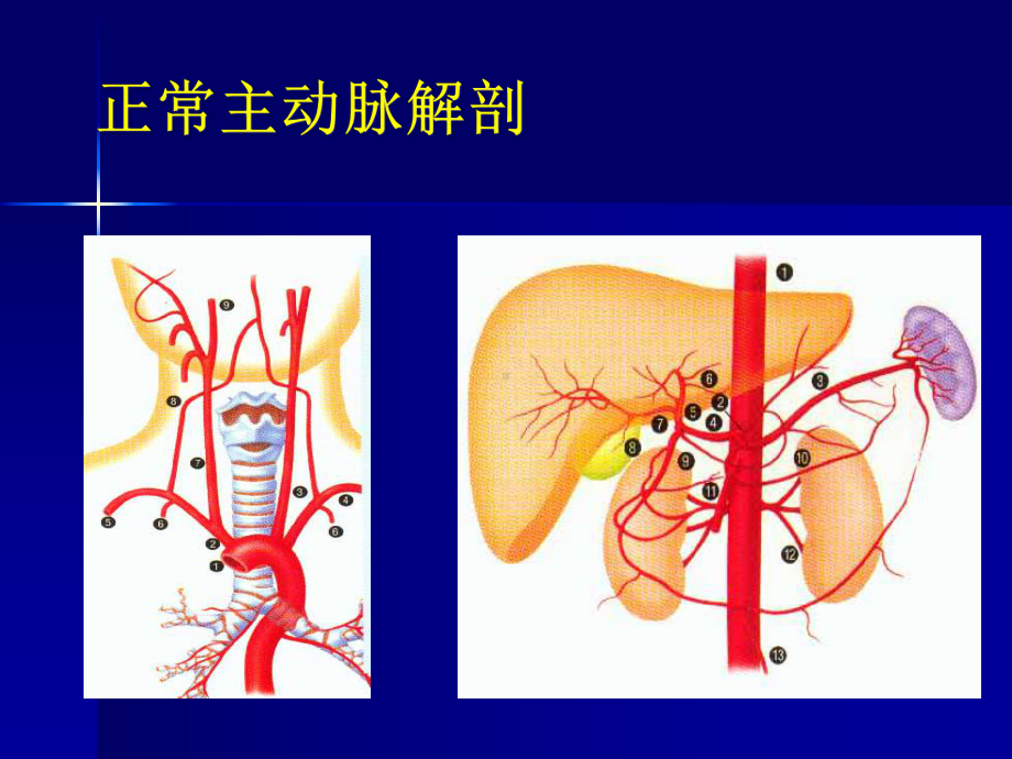 主动脉夹层及腹主动脉瘤CA影像课件.pptx_第3页