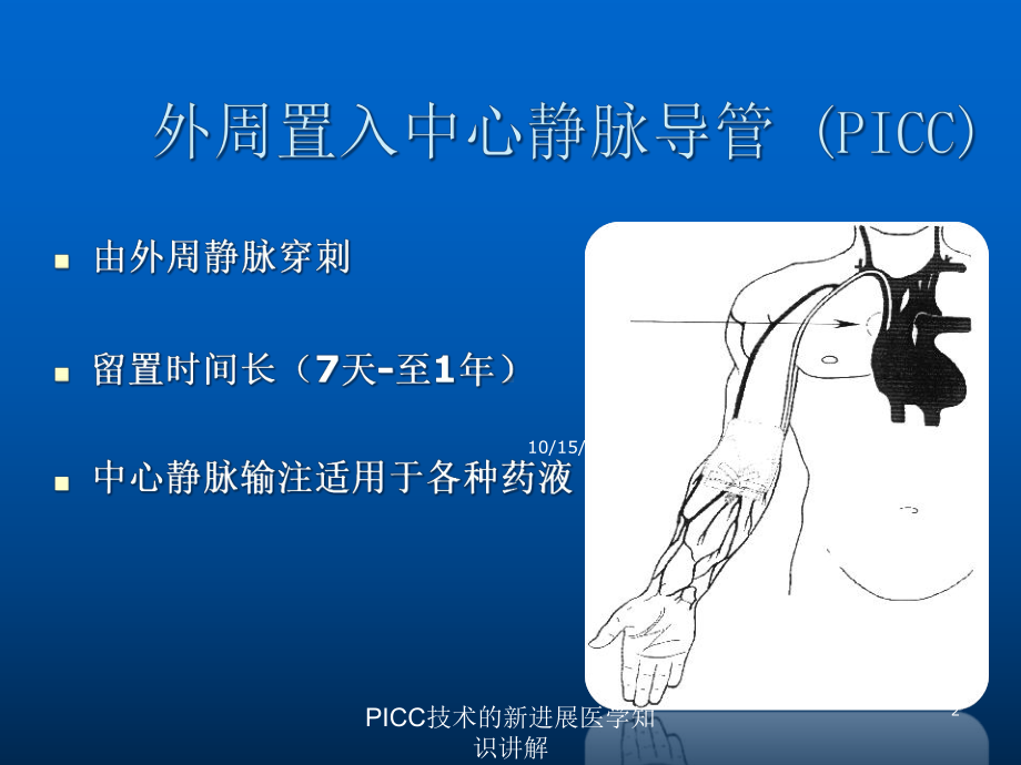 PICC技术的新进展医学知识讲解课件.ppt_第2页