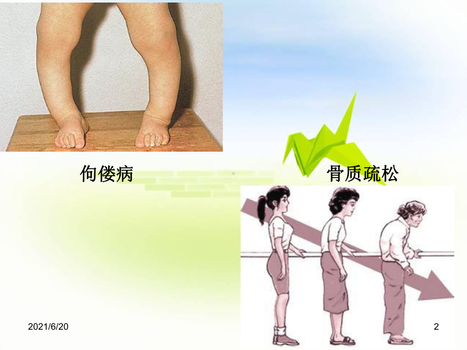 （教学课件）第十二章-骨代谢异常的生物化学诊断.ppt_第2页