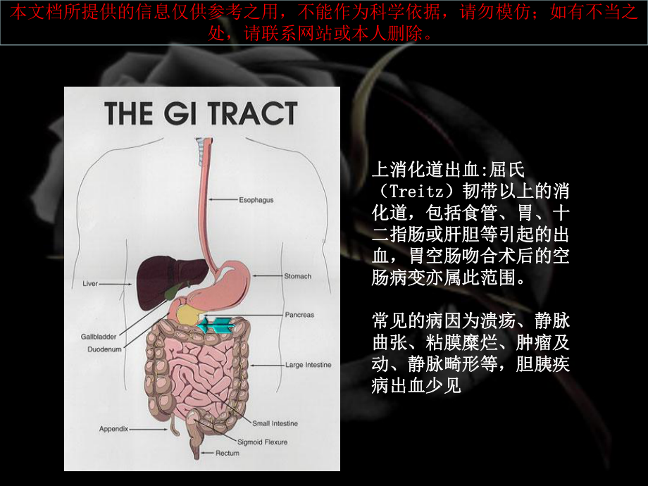 上消化道出血原因和处置培训课件.ppt_第3页