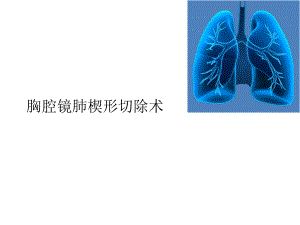 胸腔镜肺楔形切除术课件.ppt