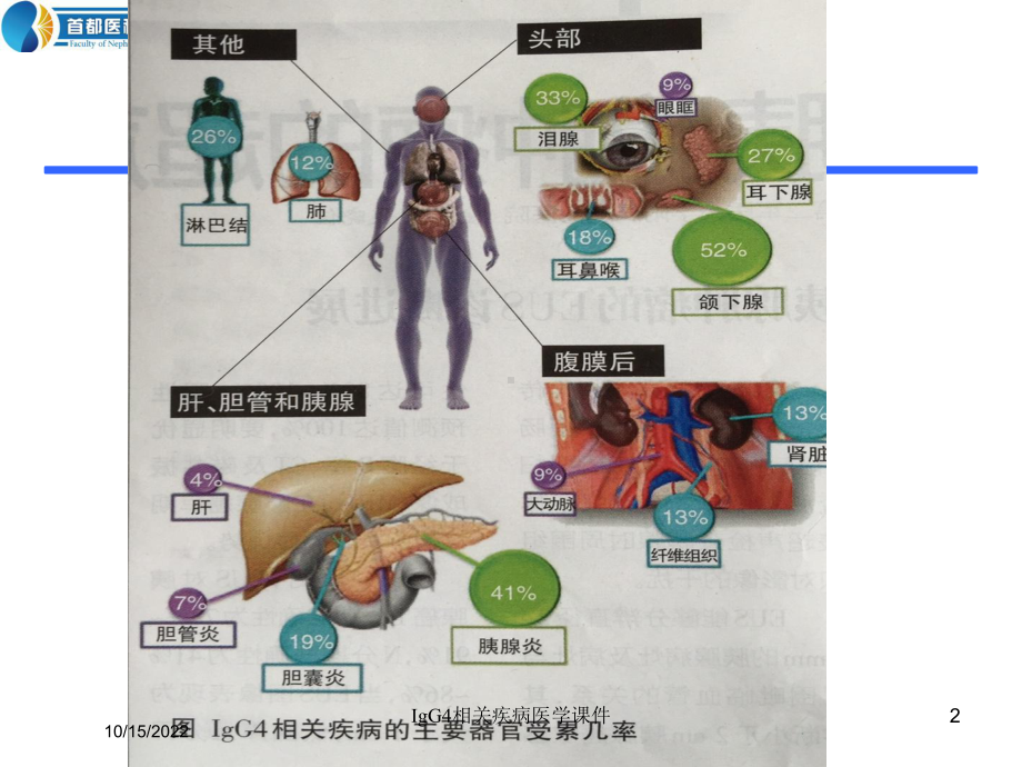 IgG4相关疾病医学课件培训课件.ppt_第2页