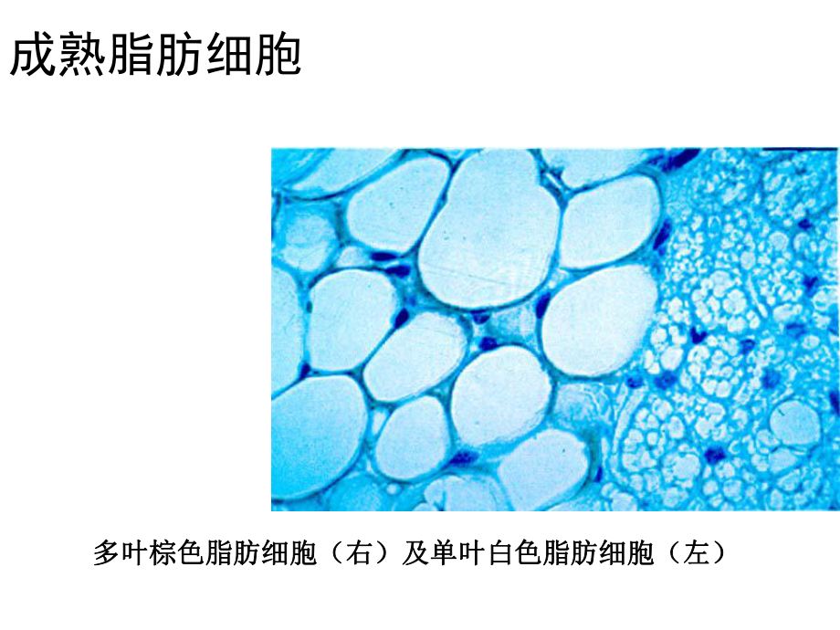 肥胖症的诊治医学课件.ppt_第3页