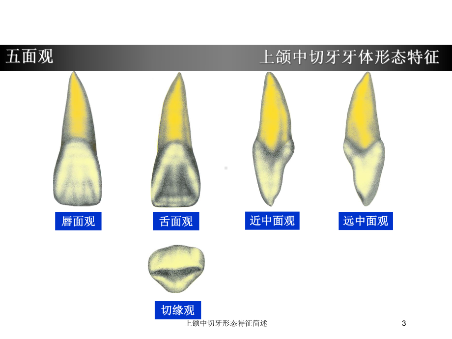 上颌中切牙形态特征简述培训课件.ppt_第3页