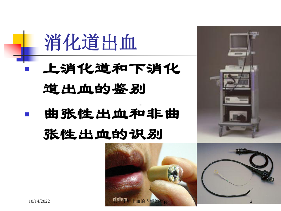 上消化道出血的内镜治疗pp培训课件.ppt_第2页