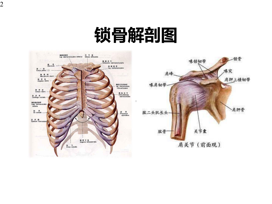 锁骨骨折护理查房-课件.pptx_第2页