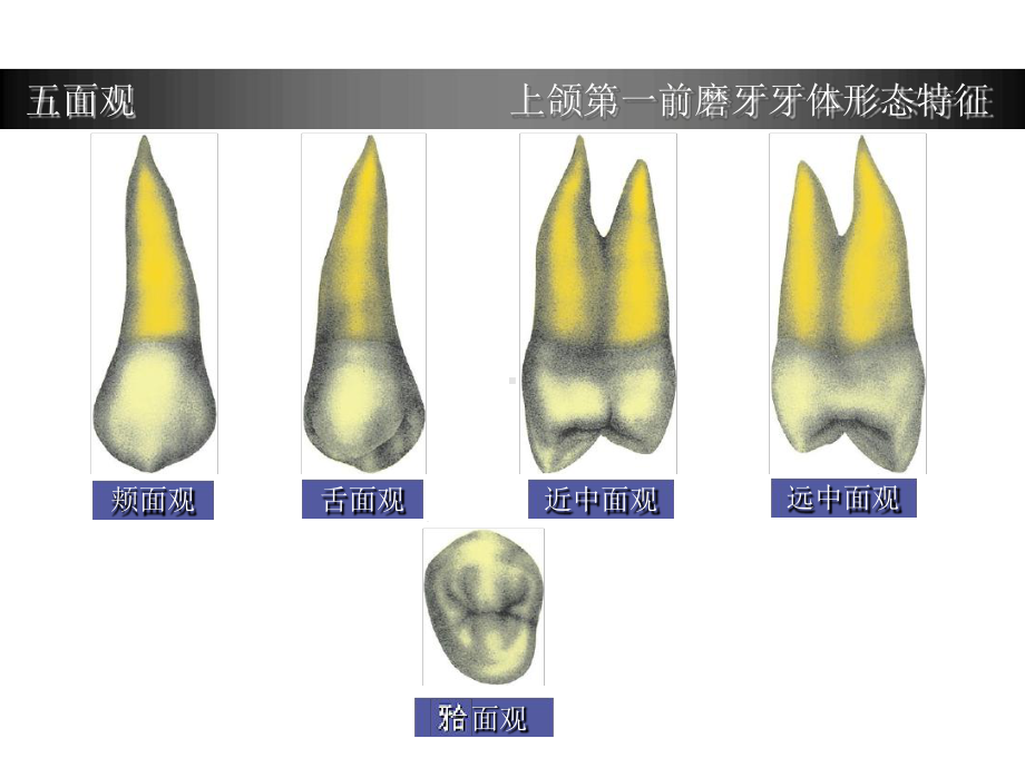 上颌第一前磨牙牙体形态简述推荐课件.ppt_第3页