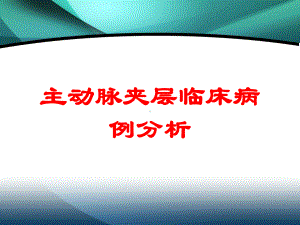 主动脉夹层临床病例分析培训课件.ppt