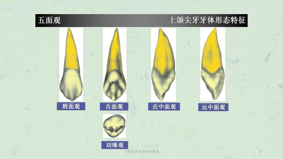 上颌尖牙牙体形态简述课件.ppt_第2页