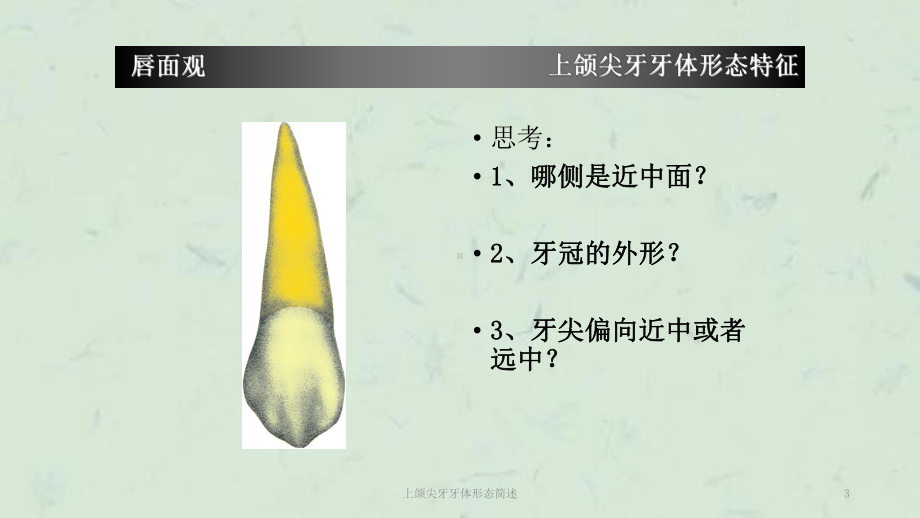 上颌尖牙牙体形态简述课件.ppt_第3页