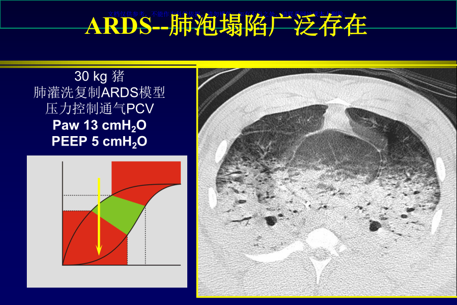 ARDS肺复张的临床实施课件.ppt_第3页