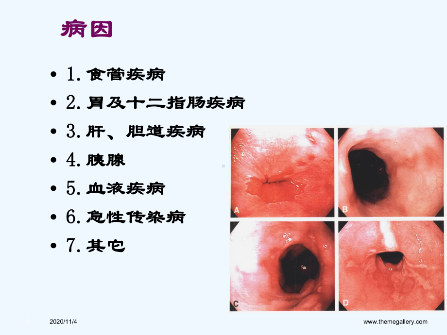 临床医学呕血与便血课件.ppt_第3页