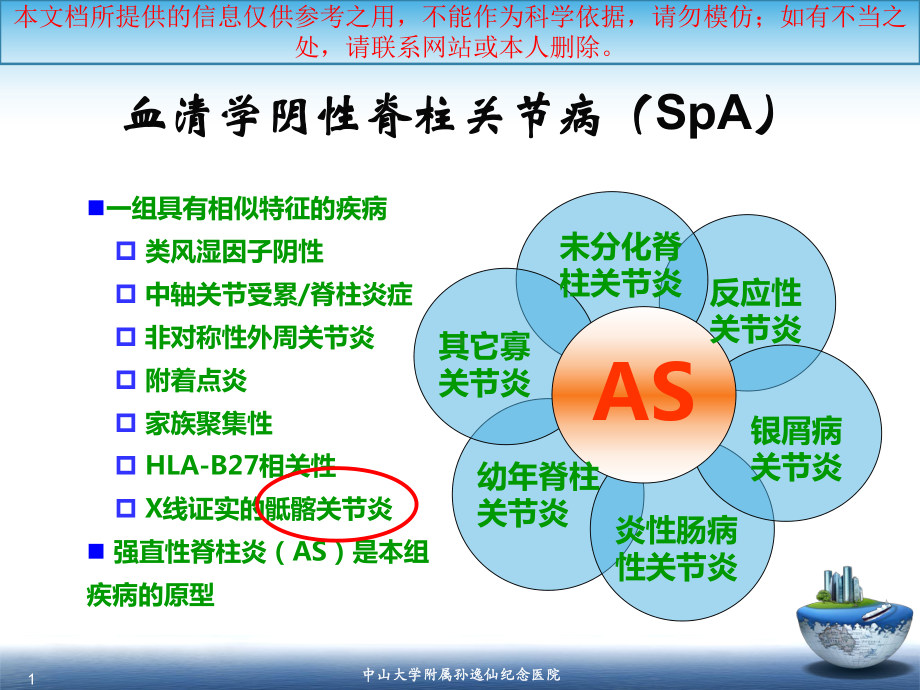 SA骶髂关节炎的影像学诊疗和鉴别诊疗培训课件.ppt_第1页