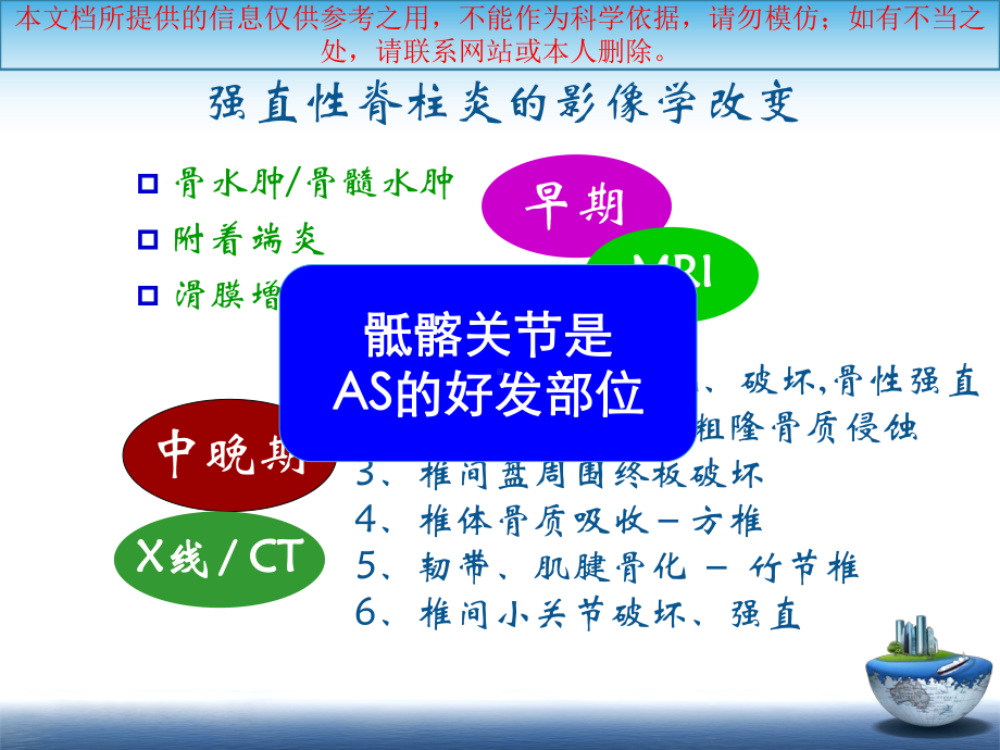 SA骶髂关节炎的影像学诊疗和鉴别诊疗培训课件.ppt_第2页