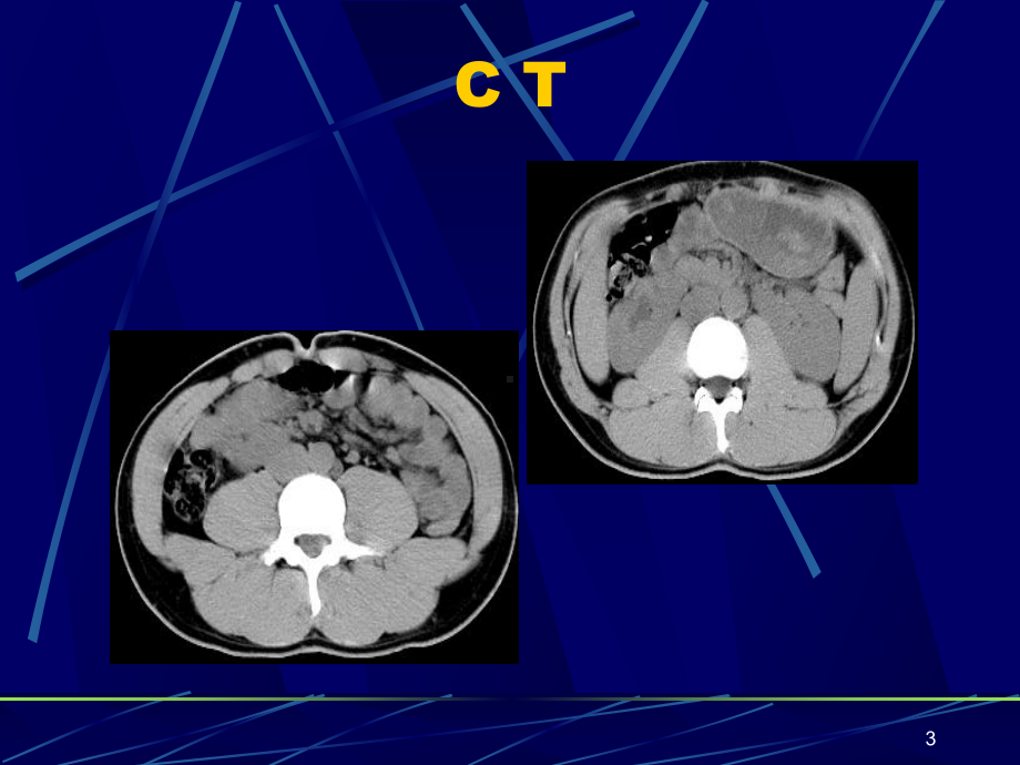 CT检查方法课件.ppt_第3页