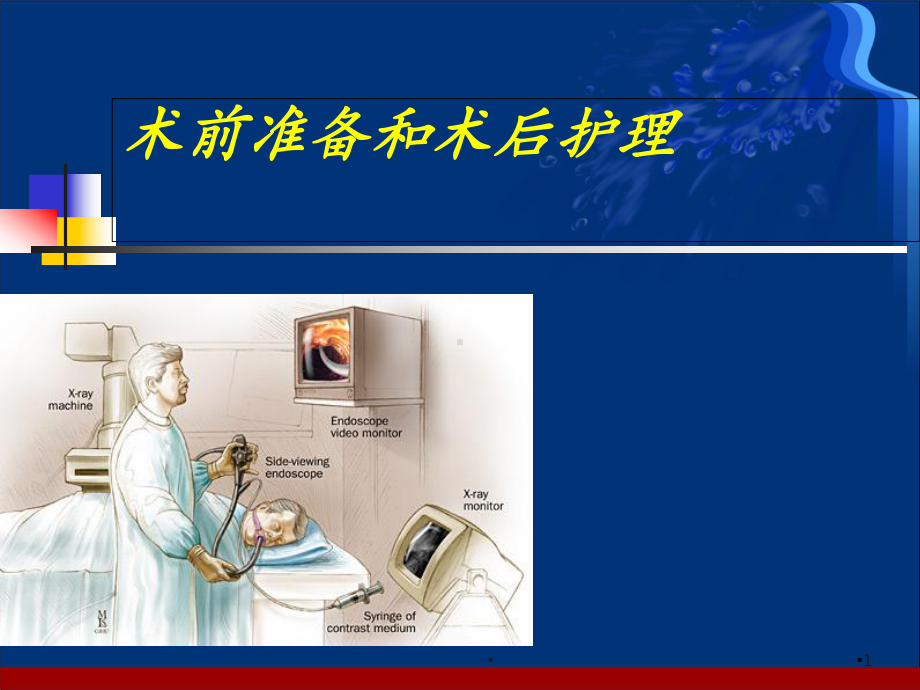 ERCP术前准备和术后护理学习课件.ppt_第1页