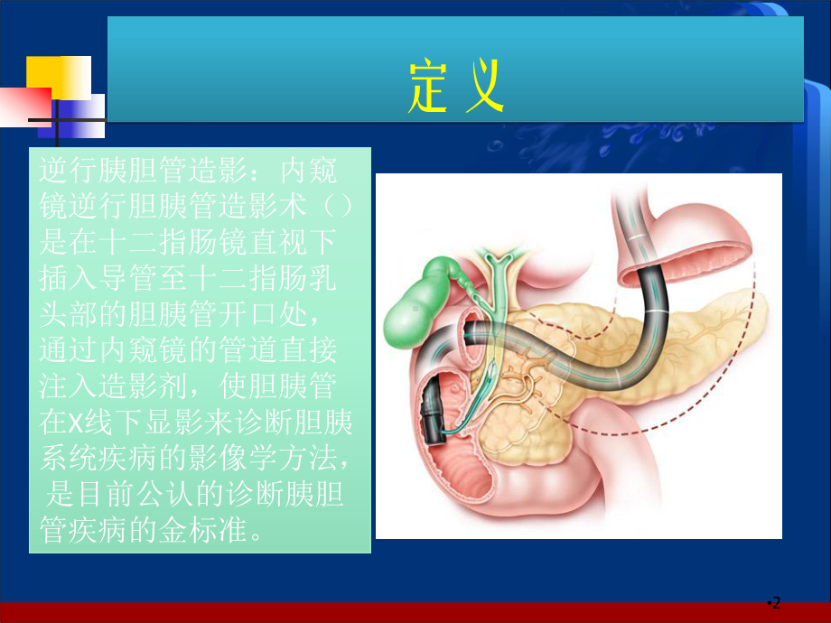 ERCP术前准备和术后护理学习课件.ppt_第2页